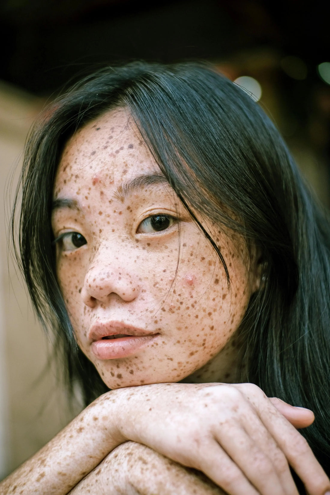 Cara Hilangkan Jeragat Muka Secara Berkesan