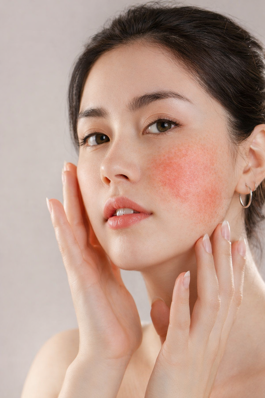 Bahan Skincare Untuk Kulit Sensitif